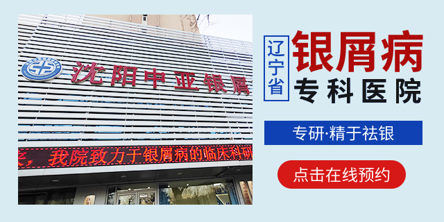沈阳银屑病皮肤病医院